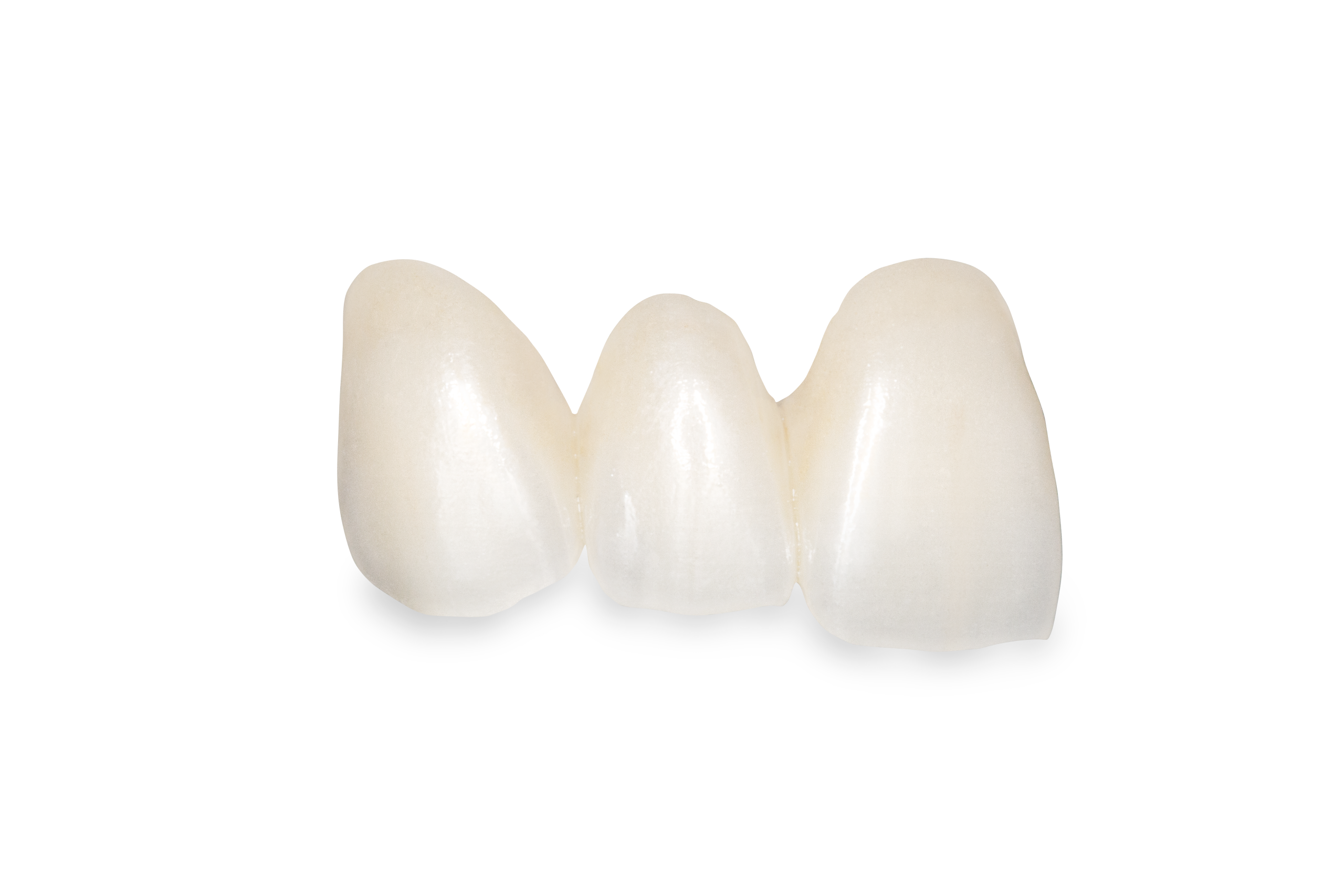 Zirconia, ceramic, Implant crowns, Translucent Zirconia, tetragonal zirconia, dentition, occlusal, parafunctional activity, esthetic solutions, anterior case, premolar case, single unit crowns, single unit bridges, CAD/CAM technology, cad cam technology dentistry, CAD technology, CAM technology